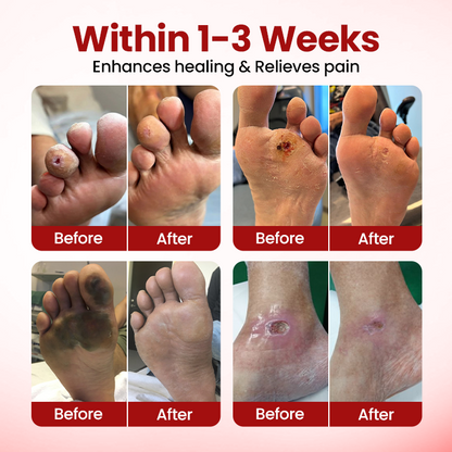 Timilk® VitaGluco Diabetic Care Cream