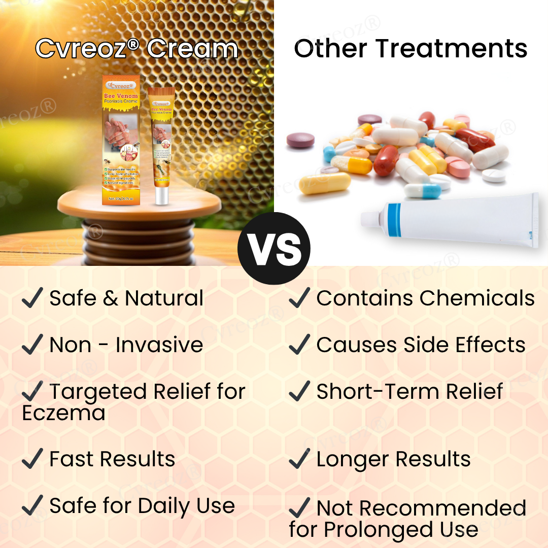 Cvreoz® Bee Venom Psoriasis Cream ✨See Visible Improvement in Just 7 Days✨