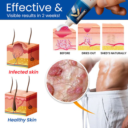 Cvreoz® GentX Relief Cream