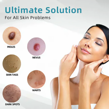 Oceahade™ All-in-One CO₂ Laser Eraser Pen | Removes Moles, Warts, Skin Flaws & Pigmentation