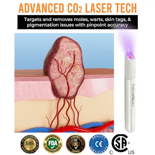 Oceahade™ All-in-One CO₂ Laser Eraser Pen | Removes Moles, Warts, Skin Flaws & Pigmentation