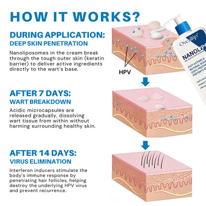 Oveallgo® NanoLipo HPV Genital Warts Eraser Cream ProX