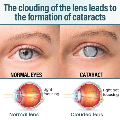 Timilk® OptiFusion Nano Eye Drops Serum —Nano Technology Restores Clear Vision,  No Glasses, No Surgery