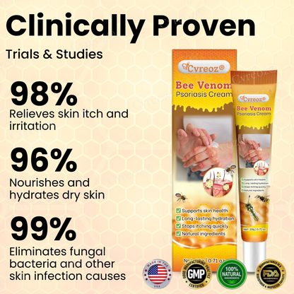 Cvreoz® Bee Venom Psoriasis Cream ✨See Visible Improvement in Just 7 Days✨