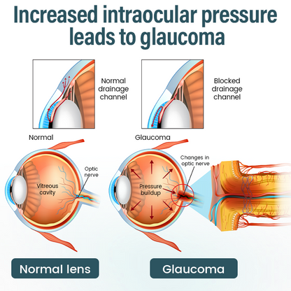 Timilk® OptiFusion Nano Eye Drops Serum —Nano Technology Restores Clear Vision,  No Glasses, No Surgery