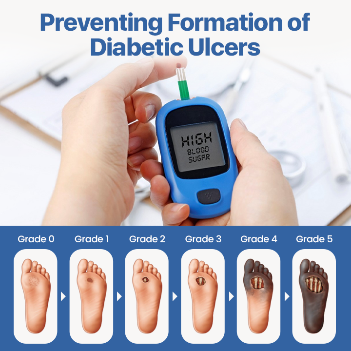 Biancat® VitaGluco Diabetes Treatment Cream✅ Heal Diabetic Wounds Faster & Safer