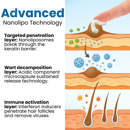 Croaie® Nanolipo Genital Warts Relief Cream🚀𝐂𝐨𝐦𝐩𝐥𝐞𝐭𝐞 𝐆𝐞𝐧𝐢𝐭𝐚𝐥 𝐑𝐞𝐬𝐭𝐨𝐫𝐚𝐭𝐢𝐨𝐧 𝐢𝐧 𝟏𝟒 𝐃𝐚𝐲𝐬🚀