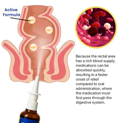 Cvreoz® Herbal Hemorrhoid Treatment Anal Spray🌟 Instant Soothing Relief🌟