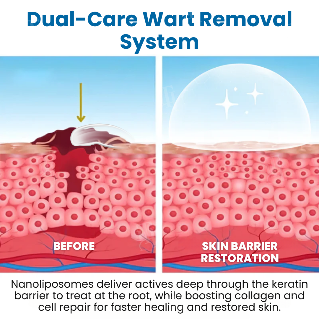 Croaie® Nanolipo Genital Warts Relief Cream🚀𝐂𝐨𝐦𝐩𝐥𝐞𝐭𝐞 𝐆𝐞𝐧𝐢𝐭𝐚𝐥 𝐑𝐞𝐬𝐭𝐨𝐫𝐚𝐭𝐢𝐨𝐧 𝐢𝐧 𝟏𝟒 𝐃𝐚𝐲𝐬🚀