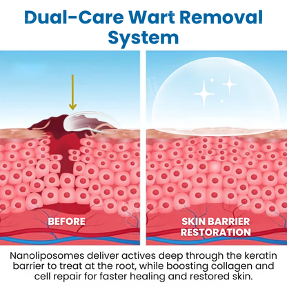 Croaie® Nanolipo Genital Warts Relief Cream🚀𝐂𝐨𝐦𝐩𝐥𝐞𝐭𝐞 𝐆𝐞𝐧𝐢𝐭𝐚𝐥 𝐑𝐞𝐬𝐭𝐨𝐫𝐚𝐭𝐢𝐨𝐧 𝐢𝐧 𝟏𝟒 𝐃𝐚𝐲𝐬🚀