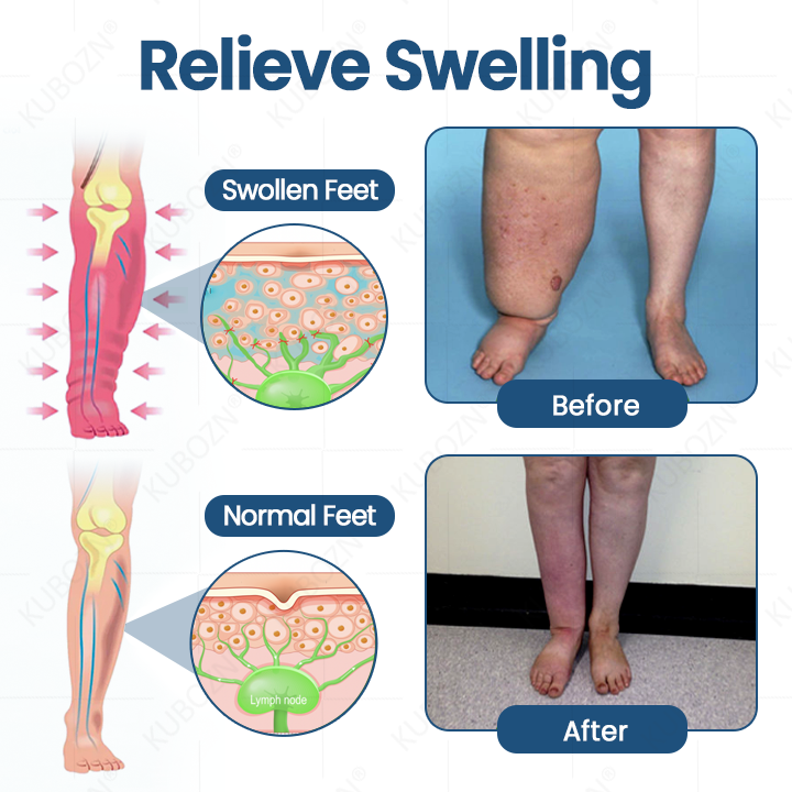 KUBOZN® Roll-On Cream for Lymphatic Drainage & Swelling Relief