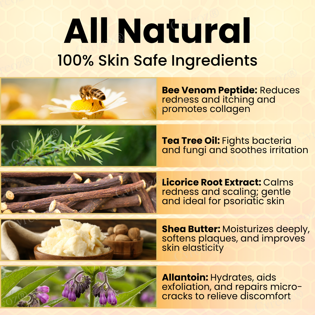 Cvreoz® Bee Venom Psoriasis Cream ✨See Visible Improvement in Just 7 Days✨